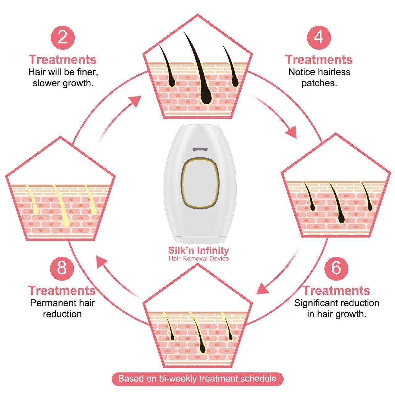IPL Laser Hair Remover